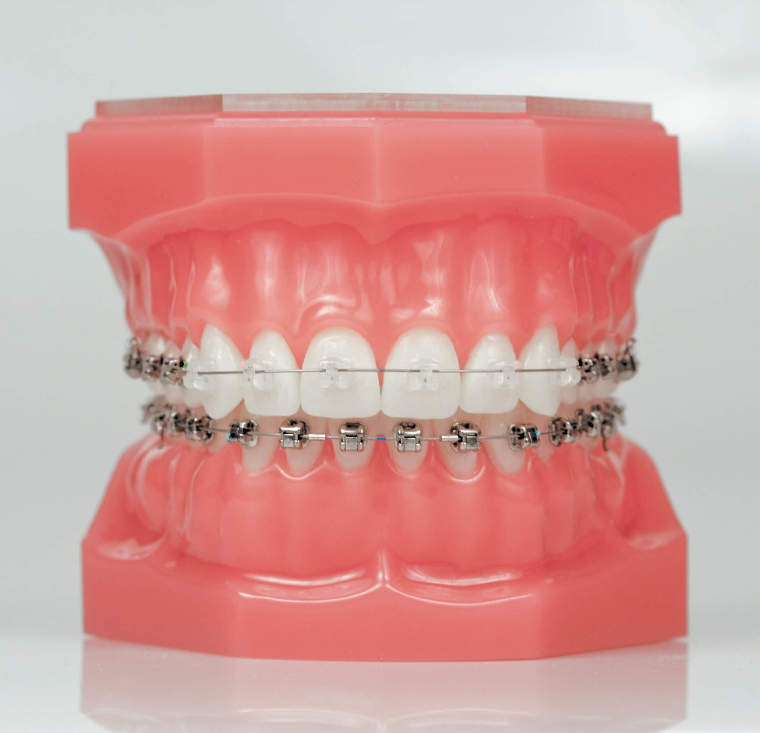 Orthodontie